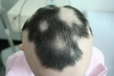 ݸļҽԺѷ